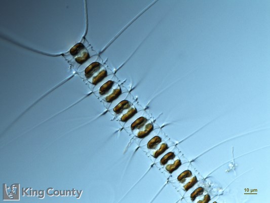 Photo of Chaetoceros vanheurckii